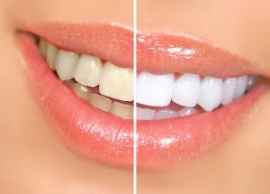Advanced Cosmetic Dentistry