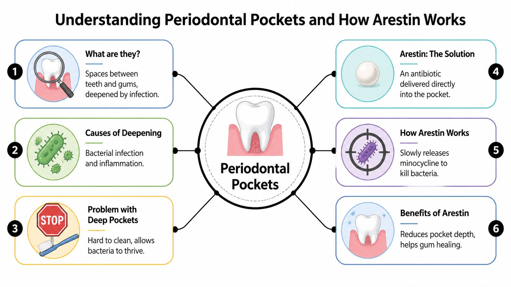 An infographic explaining periodontal pockets, their causes, and how Arestin medication is used to treat gum disease.