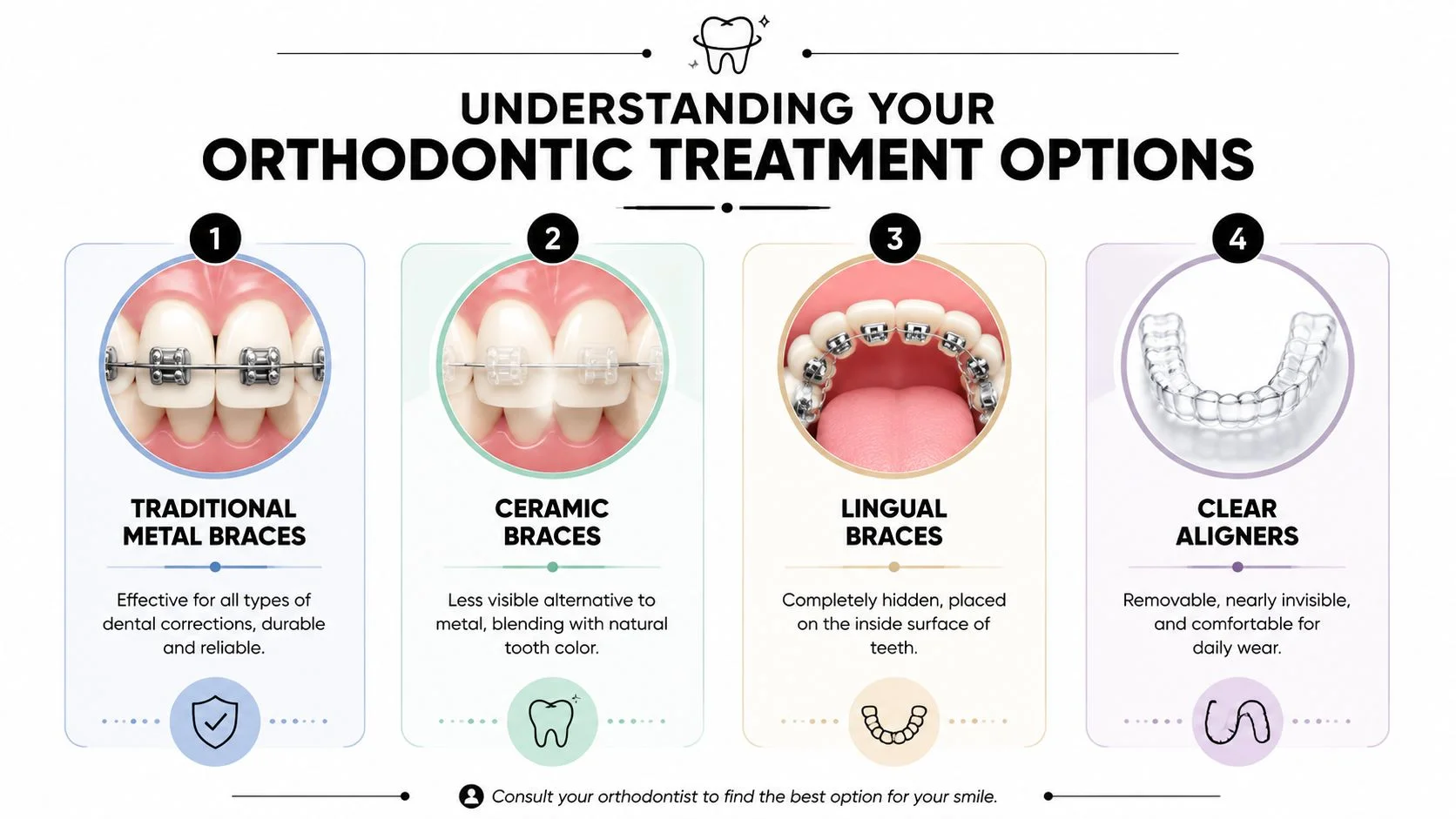 A visual guide comparing four common orthodontic treatment options including metal braces, ceramic braces, lingual braces, and clear aligners.