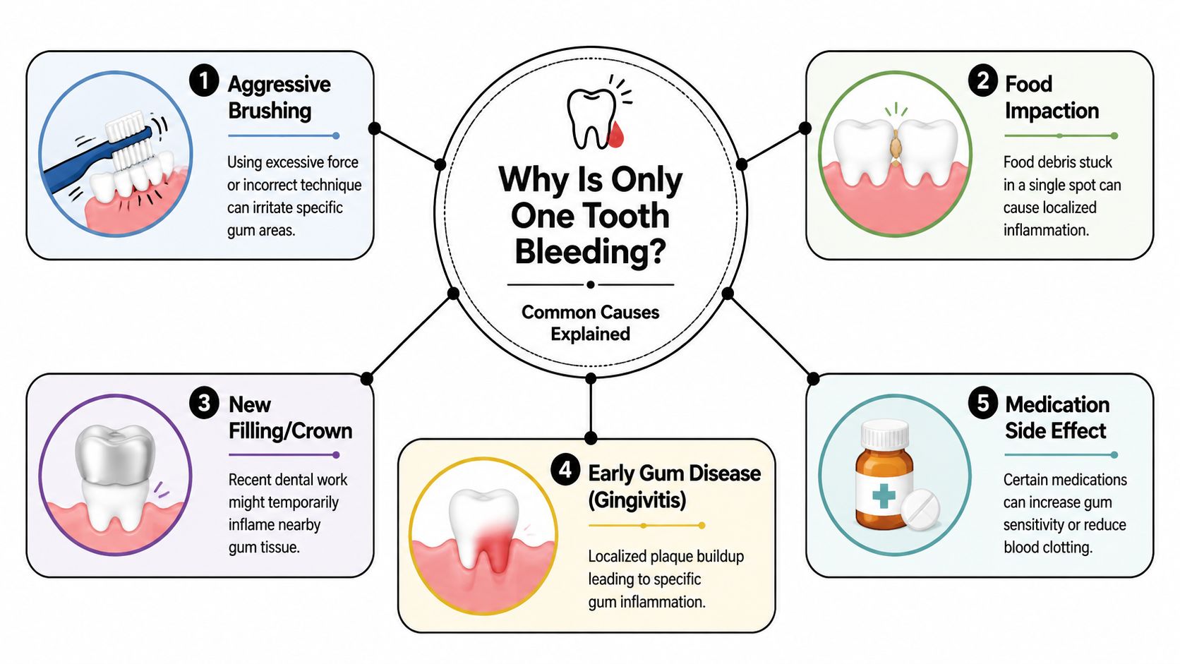 An infographic explaining common causes of localized bleeding gums around a single tooth.