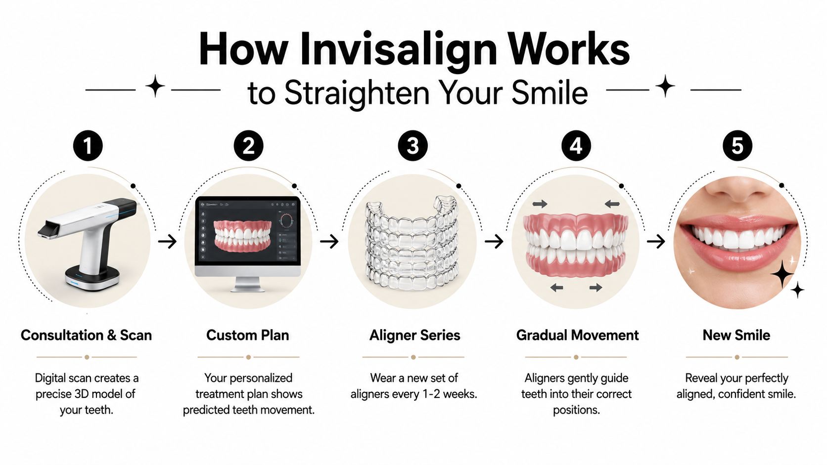 An infographic showing the five-step Invisalign treatment process from digital scanning to achieving a new smile.