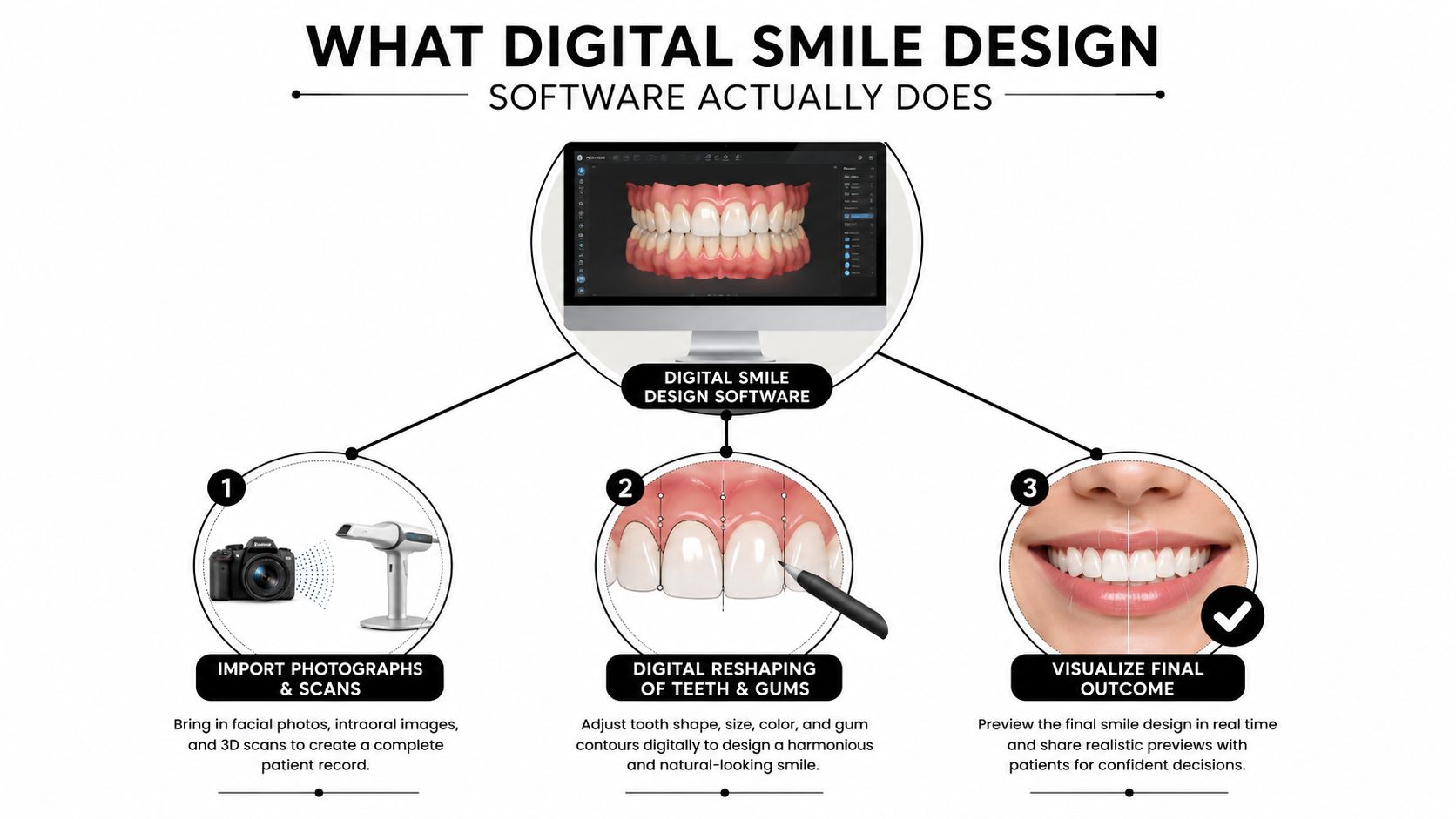 A diagram illustrating the three-step digital smile design software process from patient data to final preview.