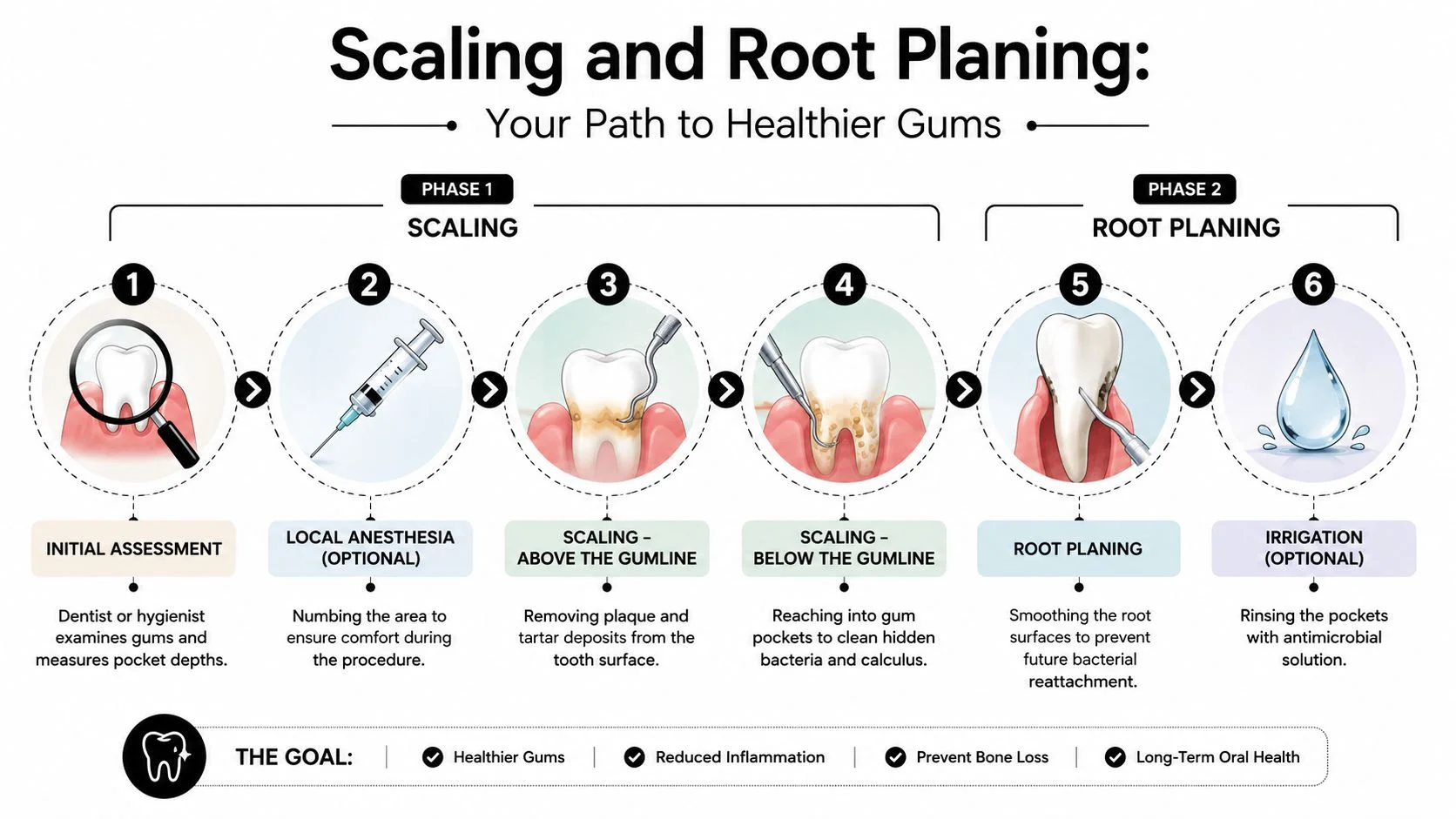 An infographic showing the step-by-step scaling and root planing dental procedure to improve gum health.