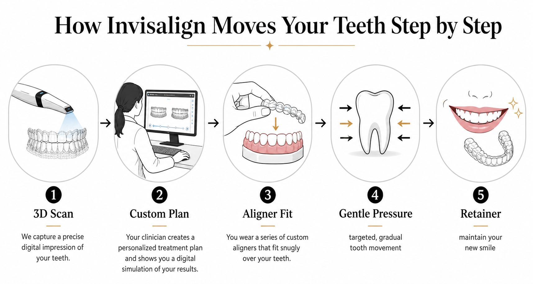 An infographic illustrating the five-step Invisalign treatment process from 3D scanning to the final retainer.