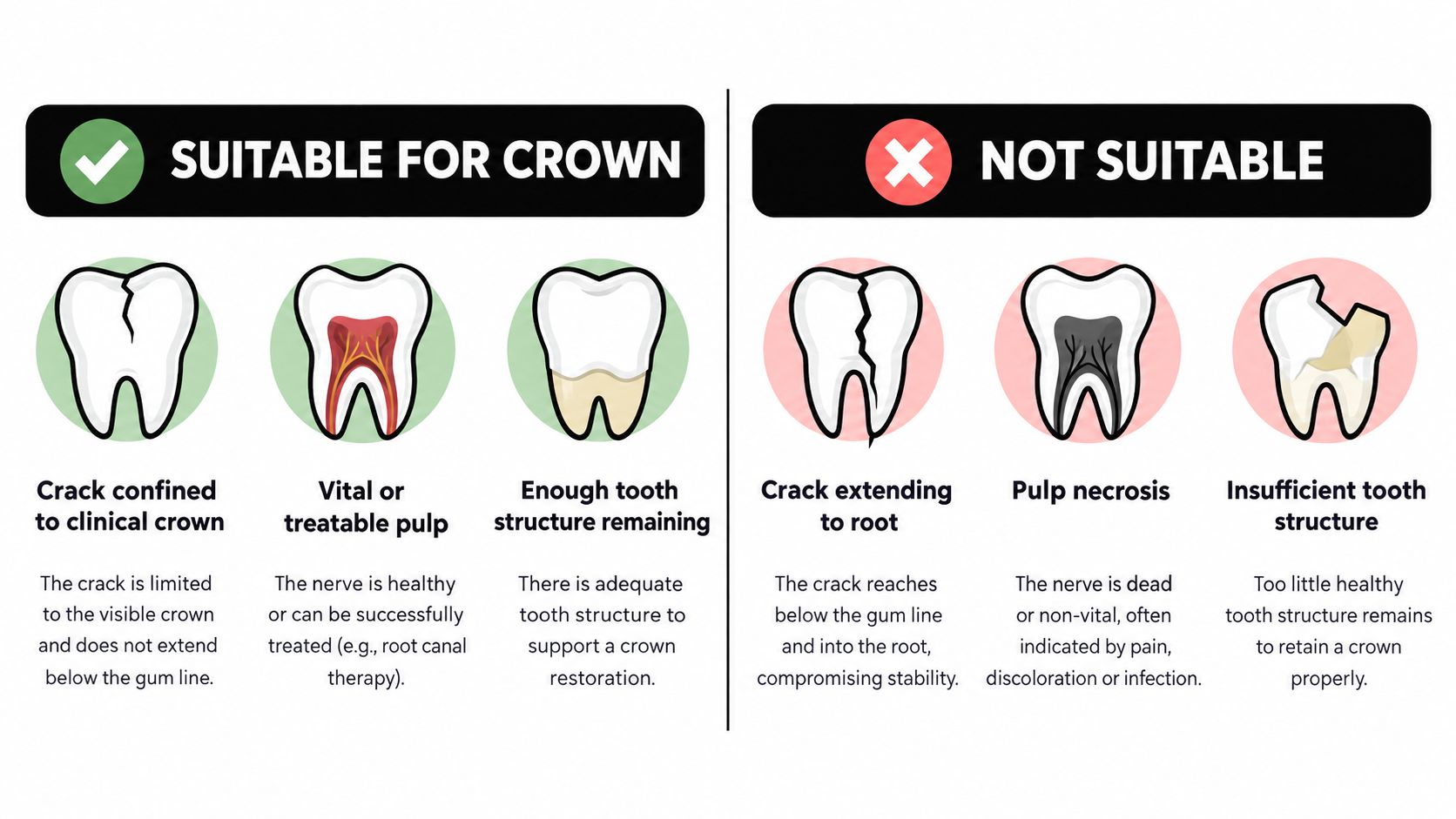 An infographic showing teeth conditions indicating when a dental crown is suitable or not suitable.