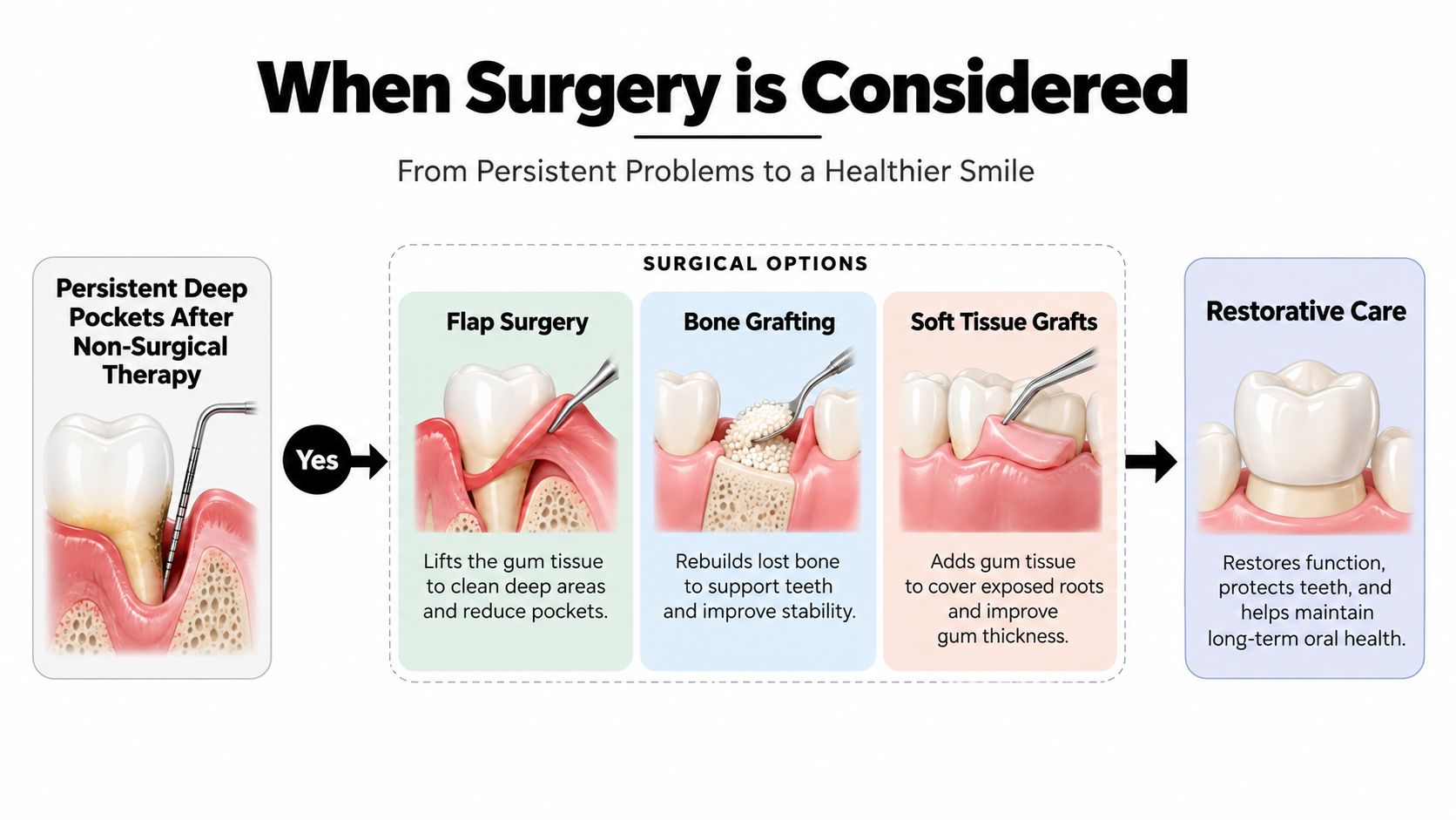 An educational infographic showing the dental surgical procedures used when gum disease persists after non-surgical treatments.